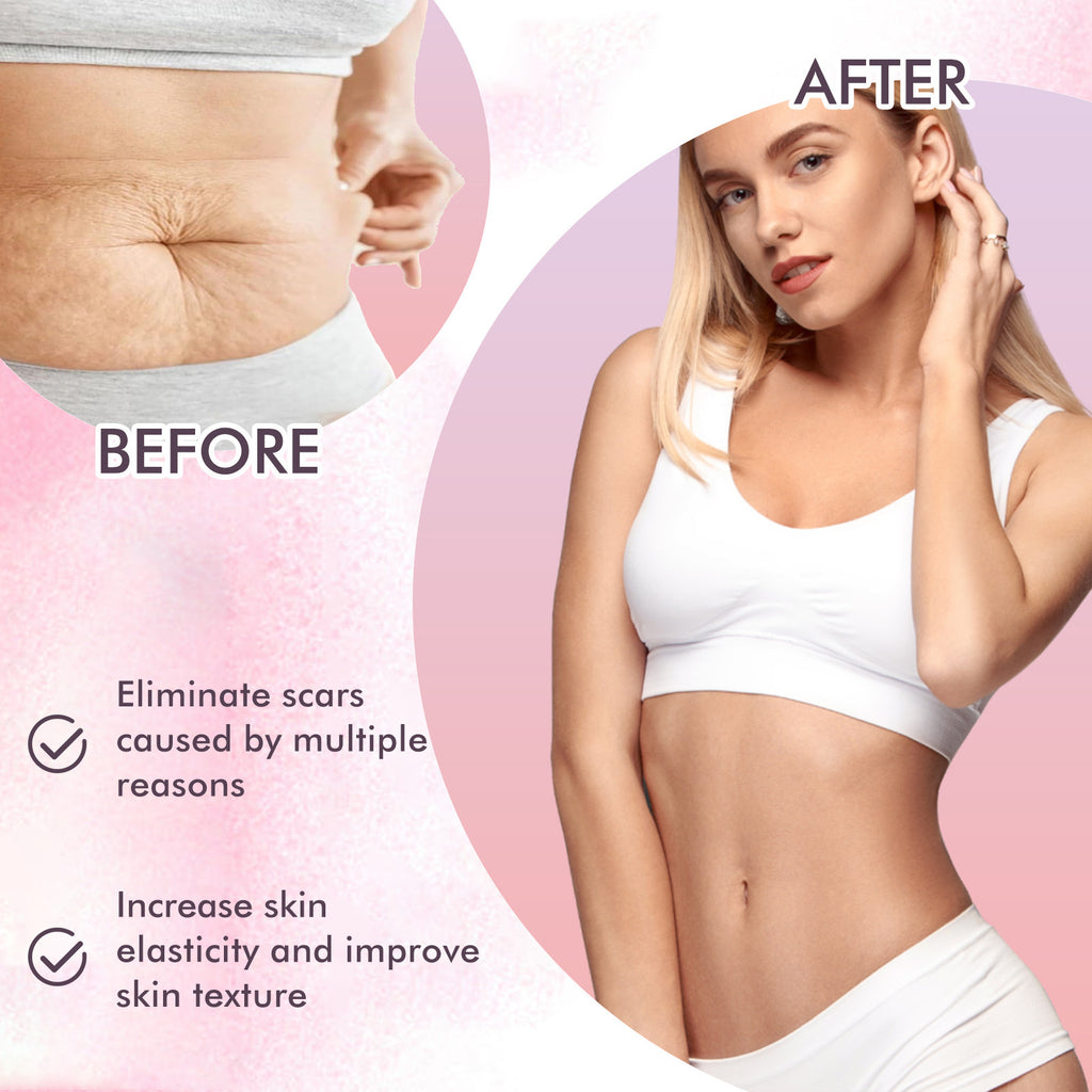 Aceite corporal para el cuidado de la piel, atenúa cicatrices y líneas de expresión del embarazo, hidrata y repara, dejando la piel del cuerpo delicada y suave