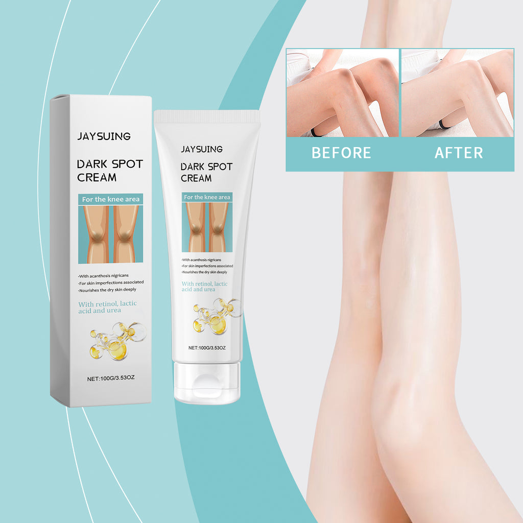 Crema de belleza para rodillas, masaje para la piel de las rodillas, hidratante y humectante, crema corporal para el cuidado de la belleza